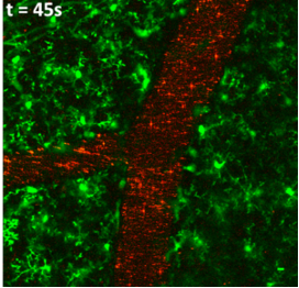 Imagerie 2 photon en condition in-vivo d'imagerie de vaisseaux sanguins cérébraux à partir de nanoparticules fluorescentes recouvertes de silice